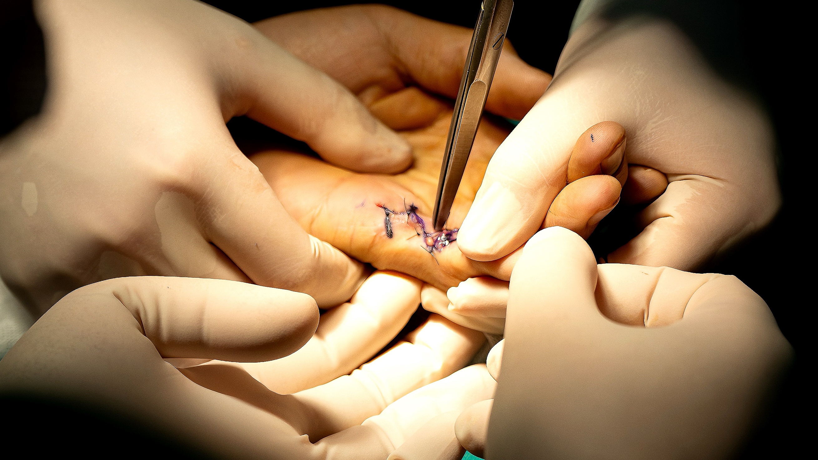 bệnh viện việt đức ảnh 21 benh vien viet duc anh 21