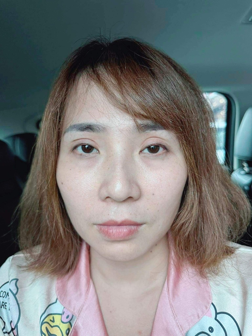 phẫu thuật thẩm mỹ ảnh 2 phau thuat tham my anh 2