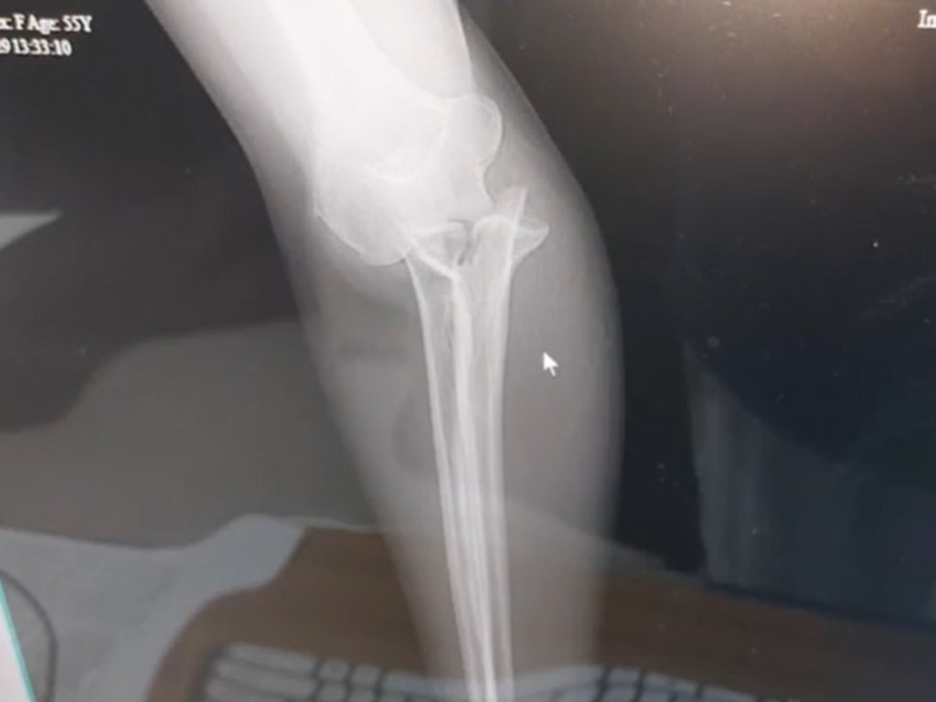 bali ảnh 2 bali anh 2