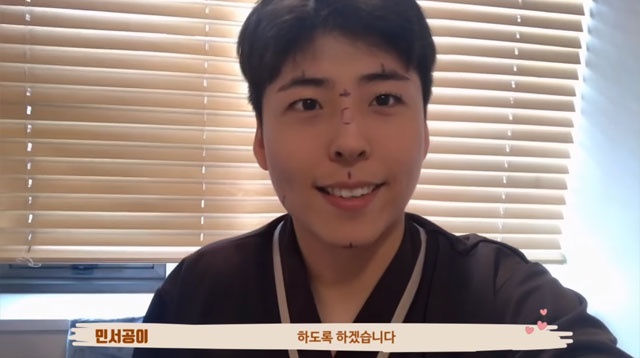 ban sao Park Bo Gum anh 9