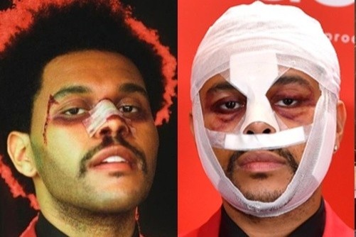 The Weeknd trang tay va nhung cu lua cua Grammy hinh anh