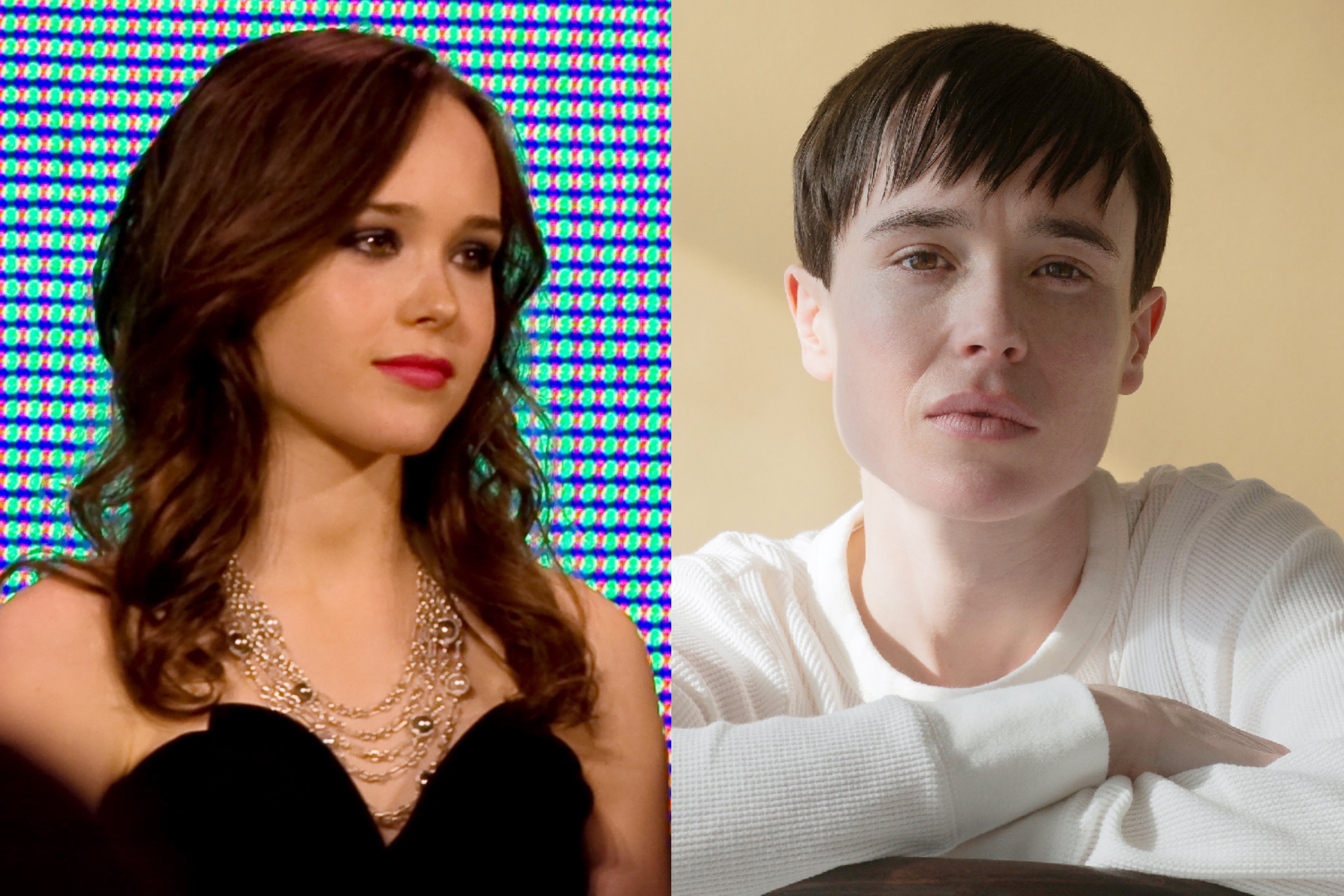 Sao phim 'X-Men' xuat hien sau phau thuat chuyen gioi hinh anh