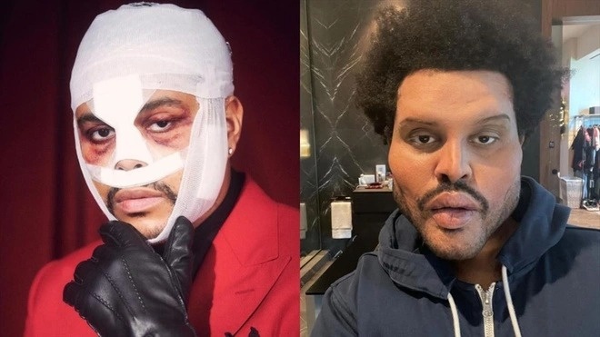 The Weeknd cạch mặt Grammy ảnh 1 The Weeknd cach mat Grammy anh 1