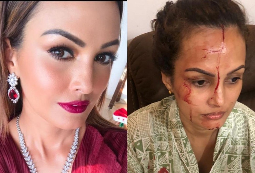 Minh tinh An Do giai thich ly do tat 7 camera thoi diem bi chong danh hinh anh