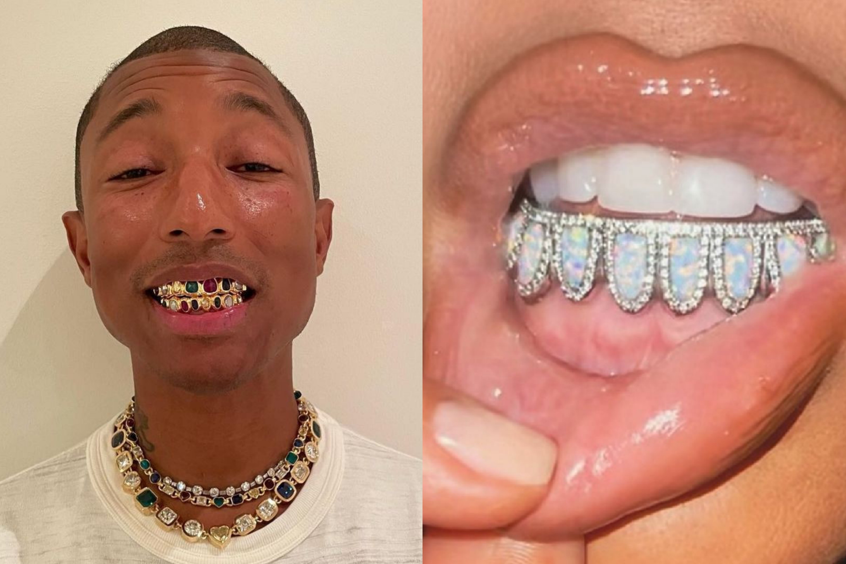 Dinh kim cuong len rang va nhung cach lam dep khong giong ai o showbiz hinh anh