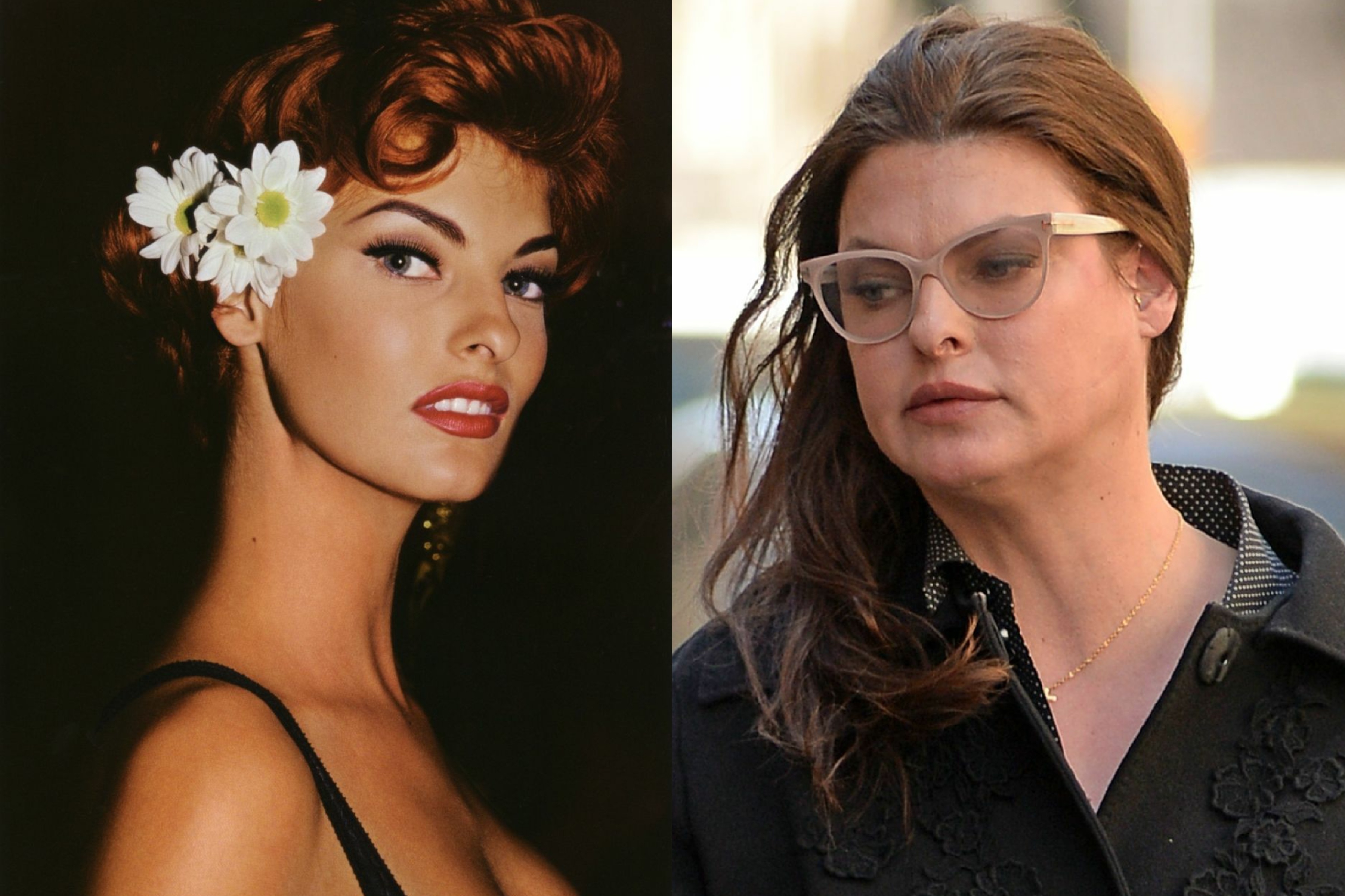 Sieu mau Linda Evangelista bi bien dang co the vi lam dep hinh anh