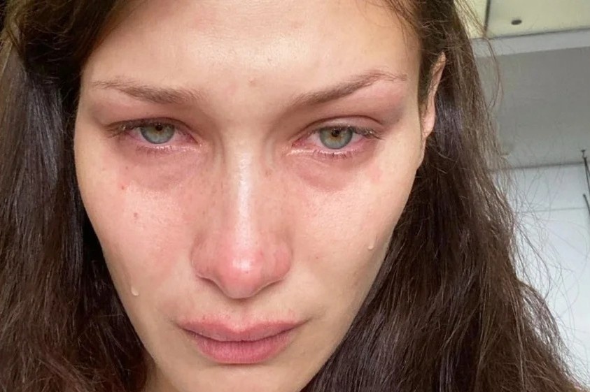 Ly do Bella Hadid thuong xuyen dang anh khoc hinh anh