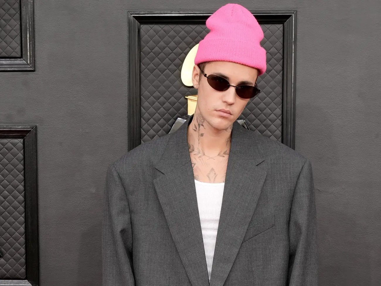 Justin Bieber liet co mat anh 3