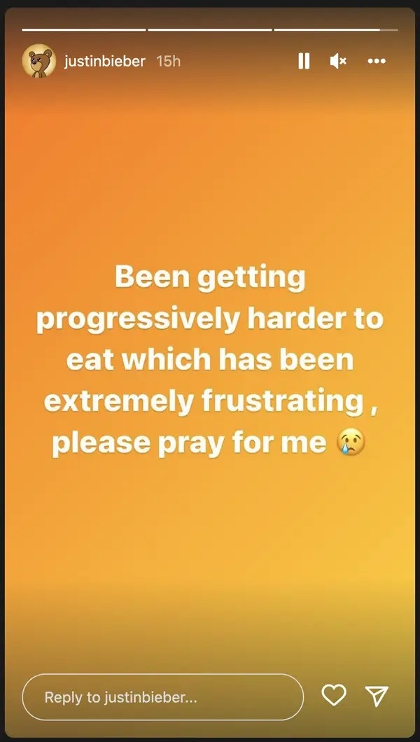 Justin Bieber liệt cơ mặt ảnh 2 Justin Bieber liet co mat anh 2