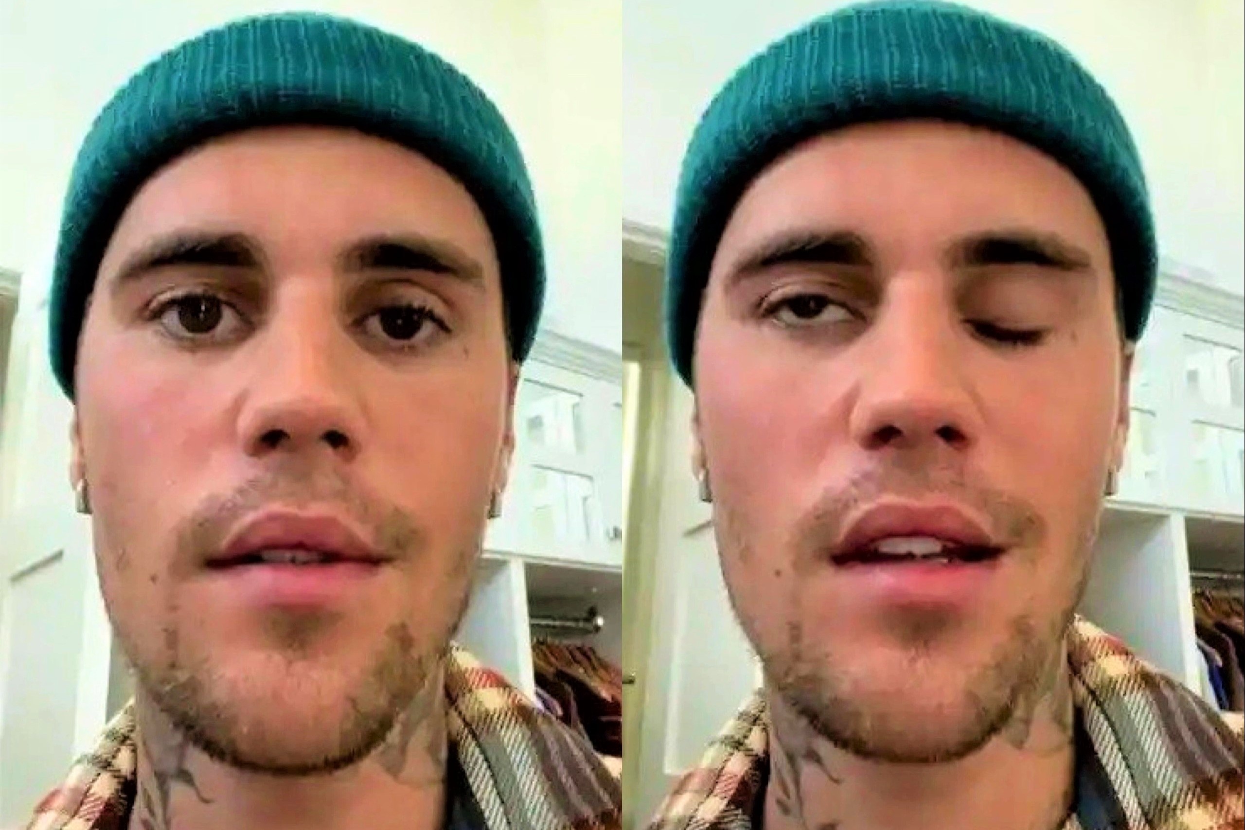 Justin Bieber cau cuu vi liet co mat hinh anh