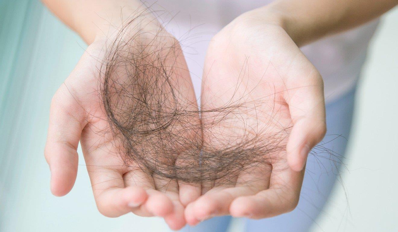 nữ sinh trung quốc hói đầu ảnh 2 nu sinh trung quoc hoi dau anh 2