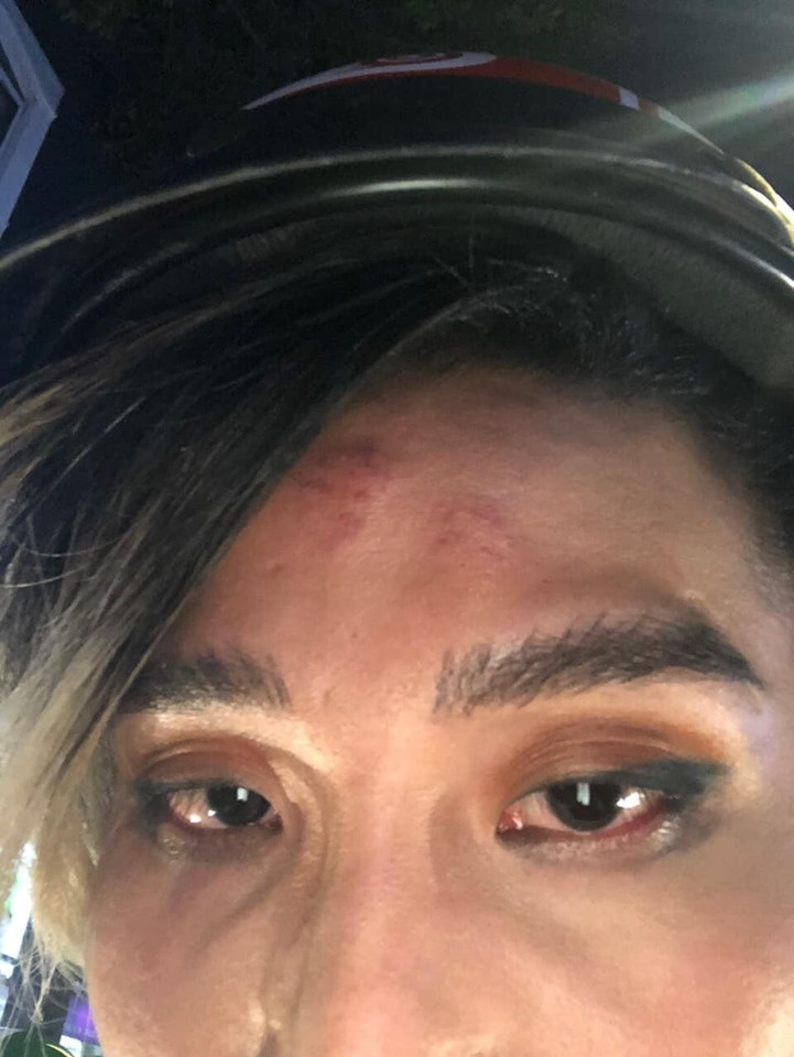 Nguoi mau The Face to bi tai xe Go Viet danh vao mat va bop co anh 2
