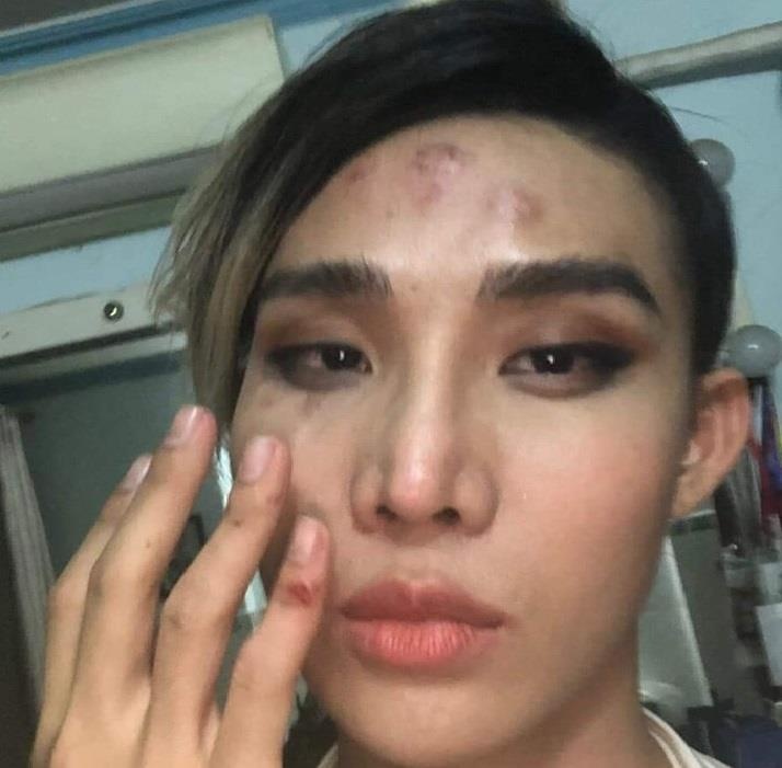 Tai xe Go-Viet to nguoc nguoi mau The Face chui 'hang ngu, tai xe ngu' hinh anh