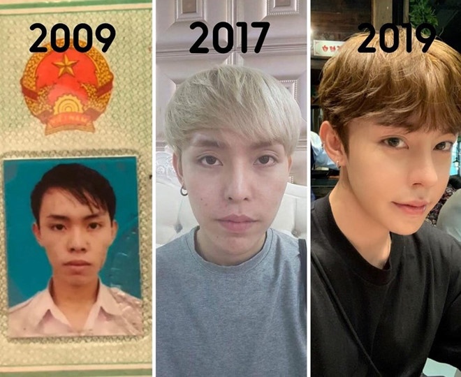 phau thuat tham my anh 1