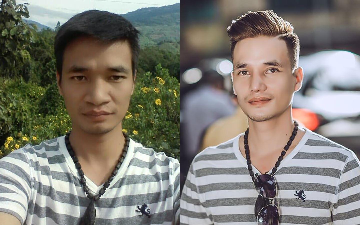 Le Roi va nhung chang trai thua nhan tung phau thuat tham my hinh anh