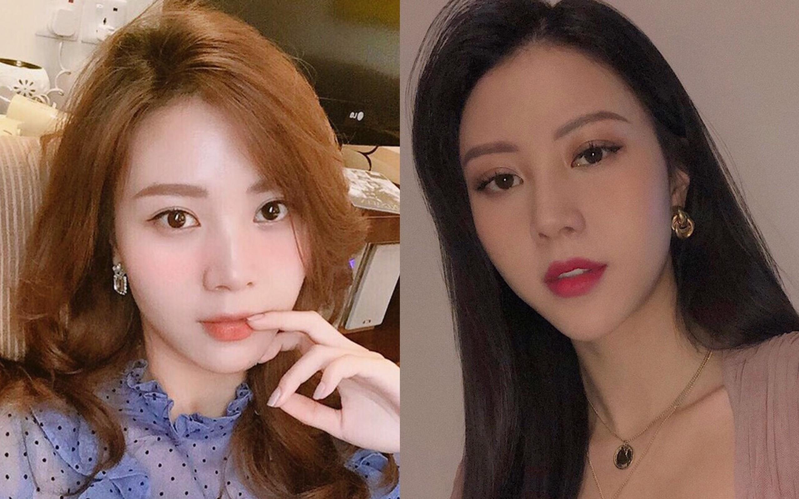 3 hot girl bi dan mang nhan xet thieu tu nhien sau phau thuat tham my hinh anh