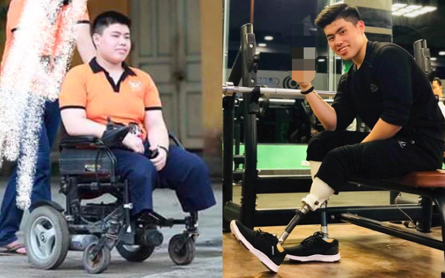 Chang trai Quang Ninh mat 2 chan: 'Nhin nua nguoi, minh cung dep trai' hinh anh