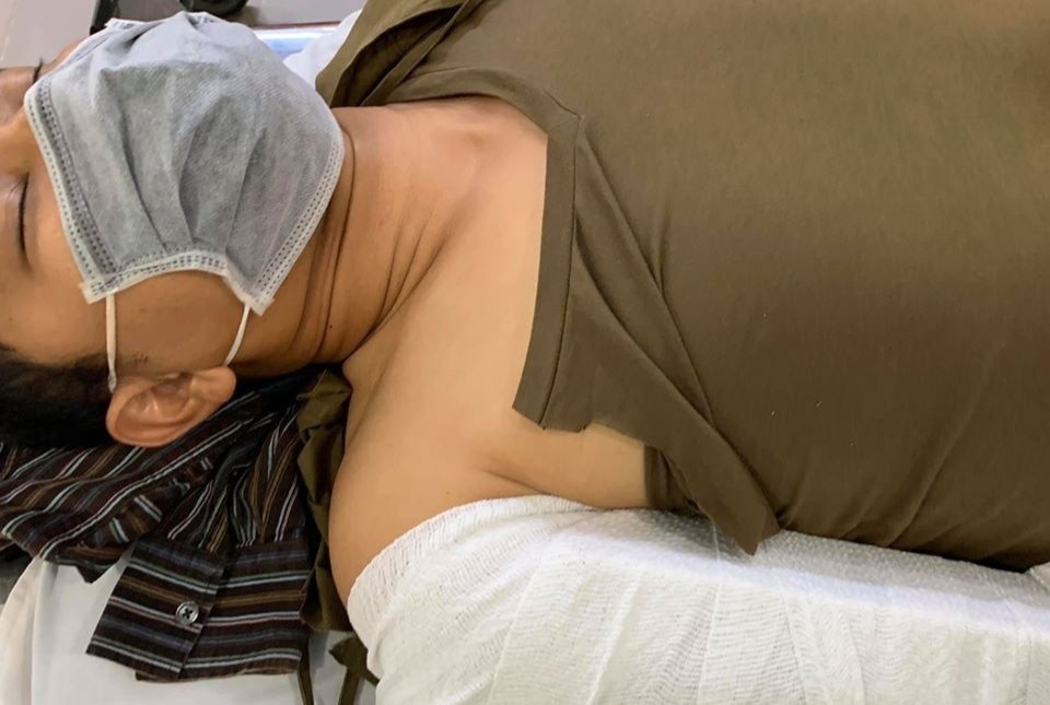 Huynh Dong bi nga gay tay khi dang quay phim moi hinh anh