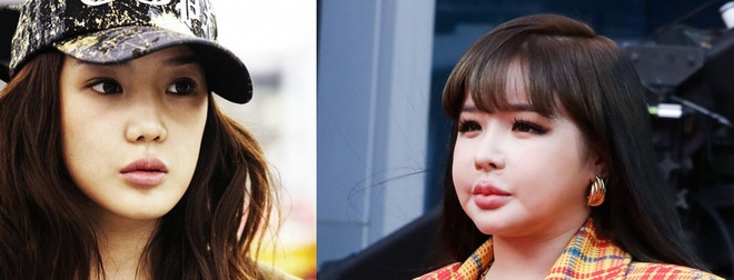 Park Bom giam can anh 3