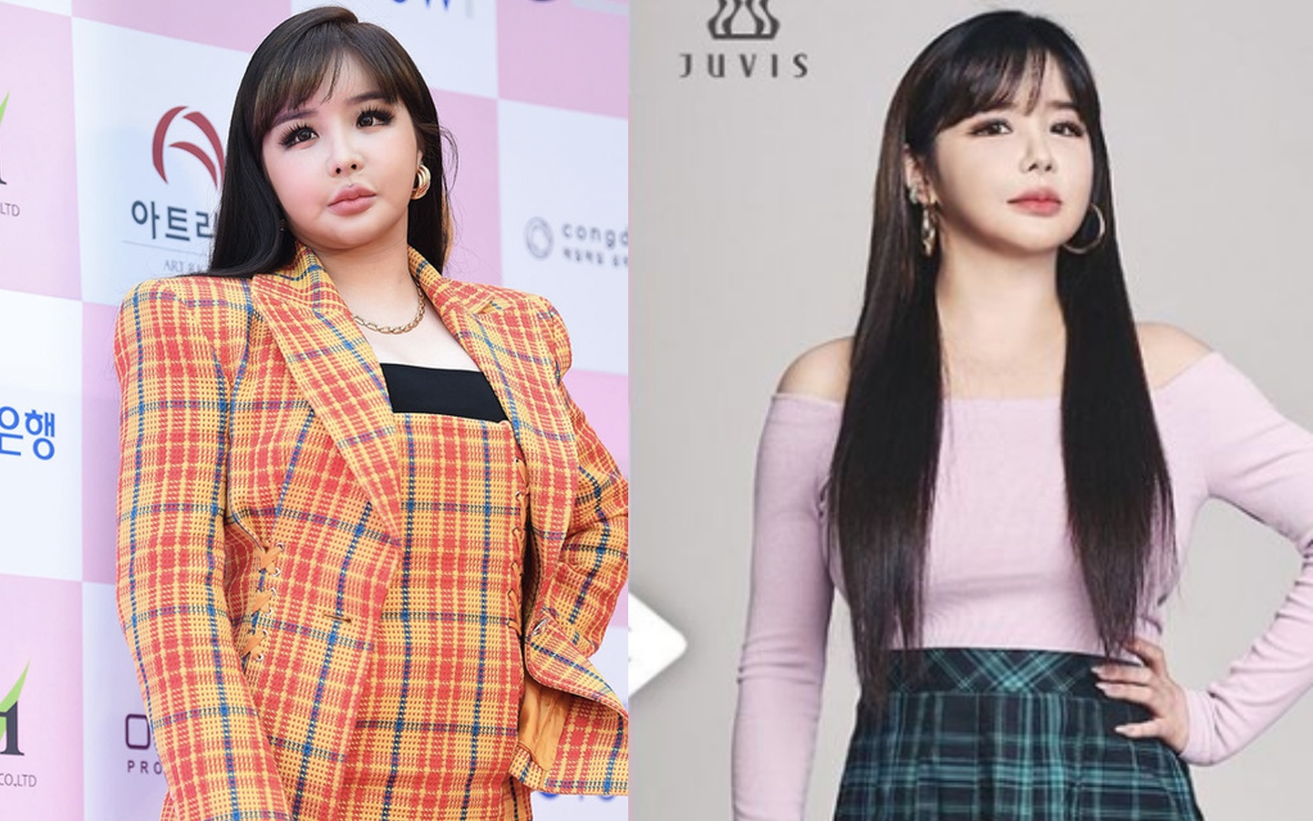 Park Bom giam 11 kg hinh anh