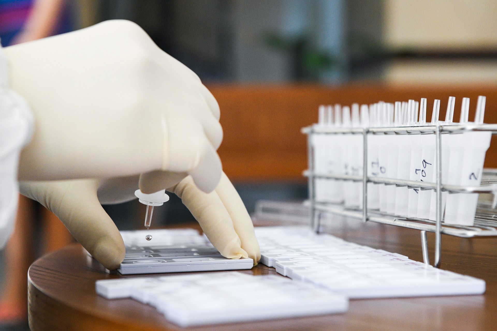 Cuoc song dao lon,  dich covid-19 bung phat,  dai dich covid-19 anh 22