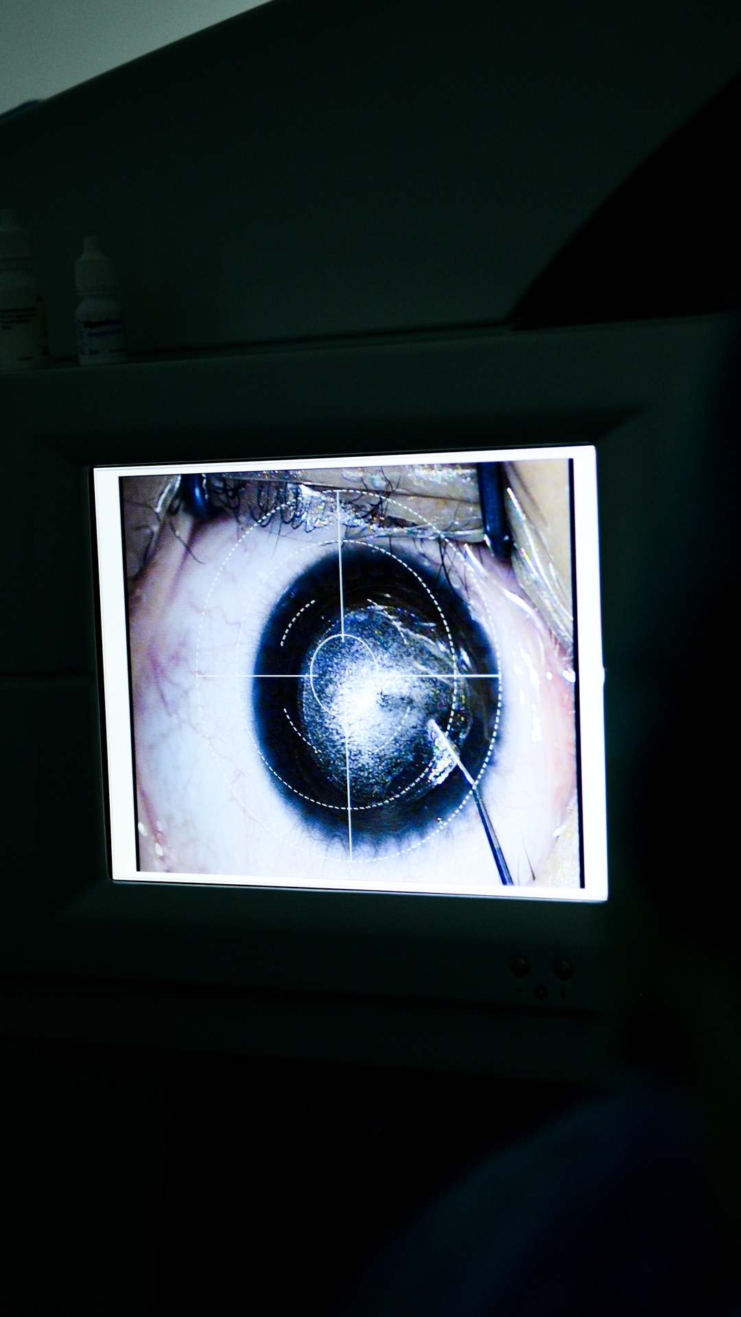 co giao day yoga,  mo mat can,  vien mat Ha Noi anh 39