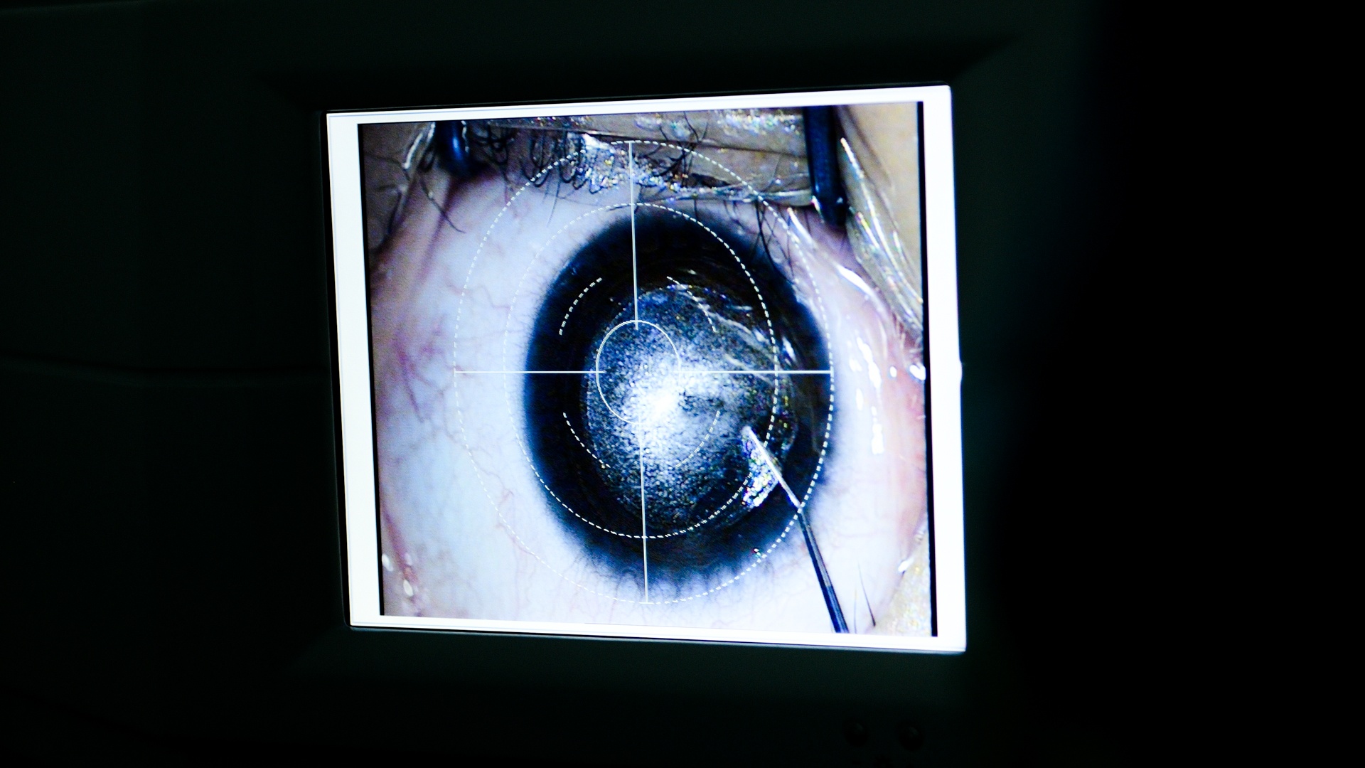 co giao day yoga,  mo mat can,  vien mat Ha Noi anh 38