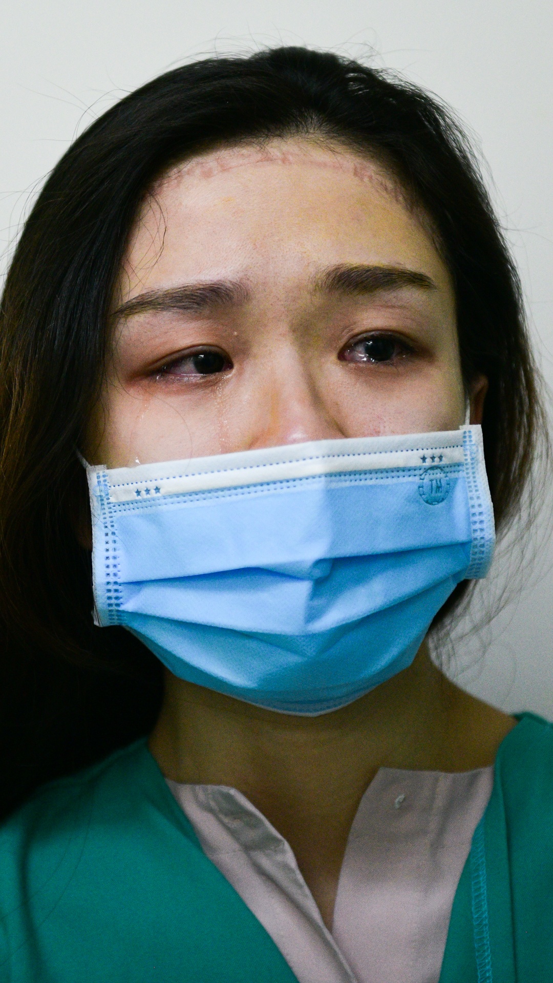 co giao day yoga,  mo mat can,  vien mat Ha Noi anh 40