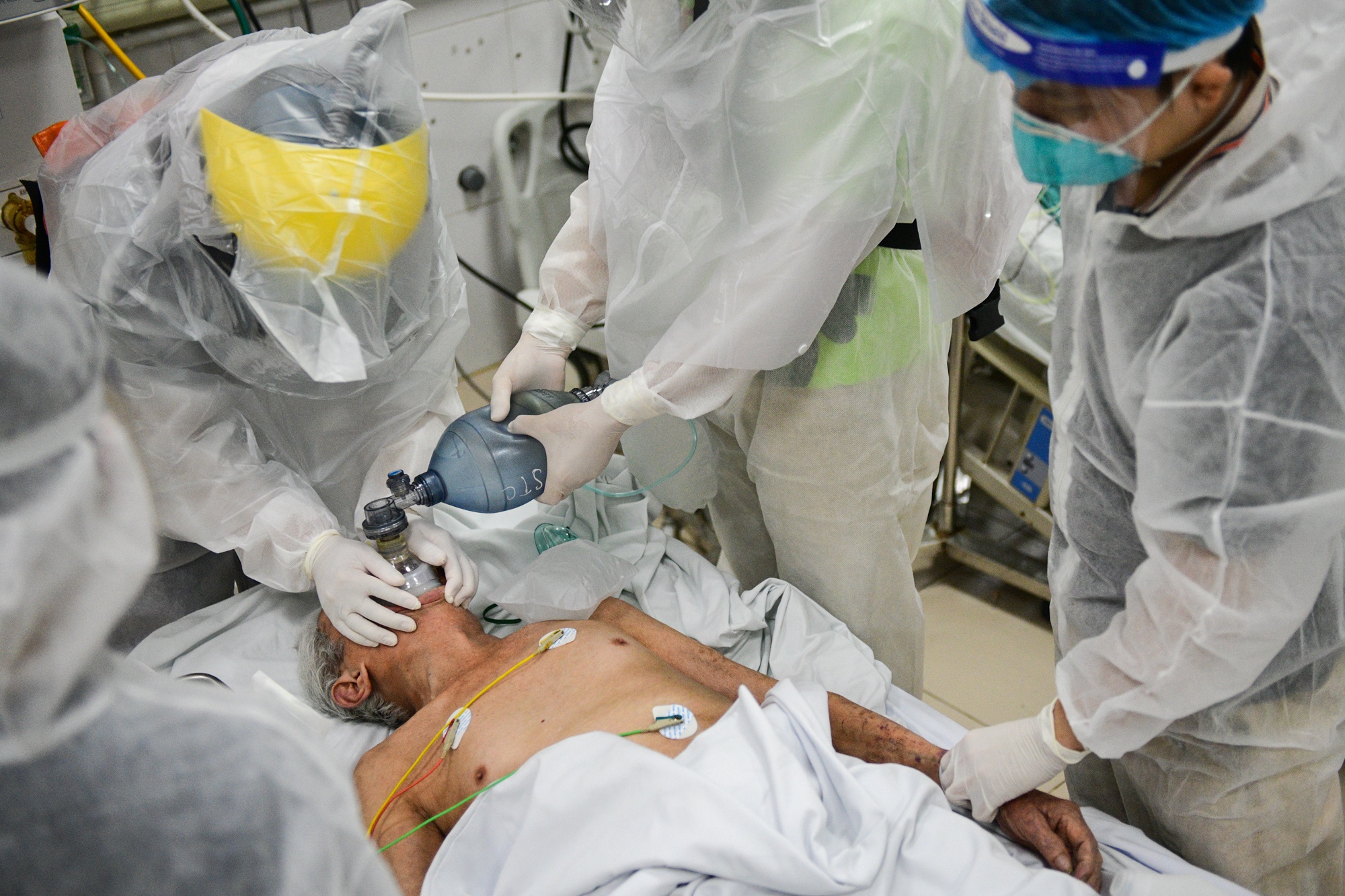 Ha Noi dang dieu tri 332 benh nhan Covid-19 nang hinh anh