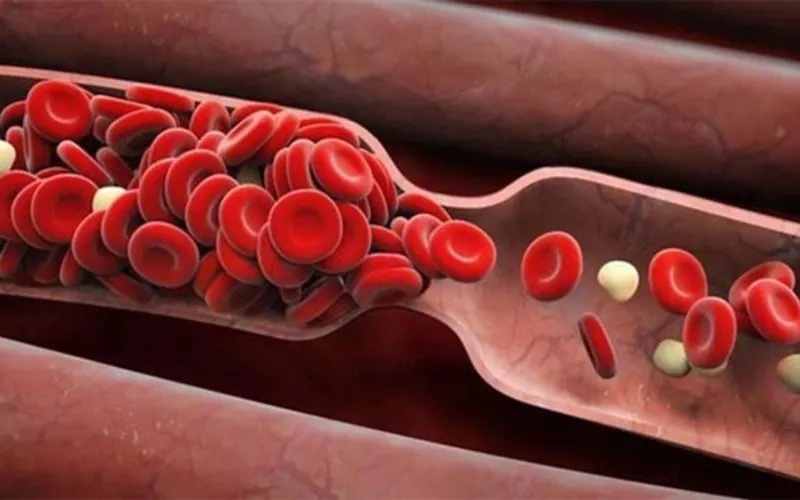 Phan tu ti hon giup ban tranh xa nhoi mau co tim hinh anh