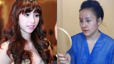 Muon kieu hau phau thuat tham my cua hot girl Viet hinh anh