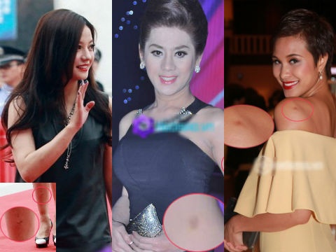 Nhung 'vet tich' kho hieu tren co the sao hinh anh