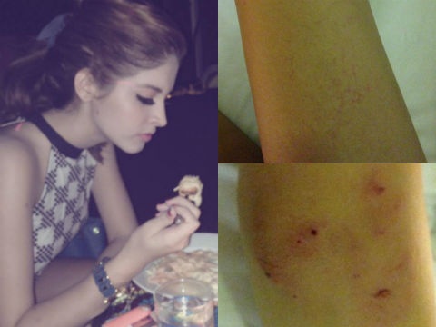 Andrea bi cuop keo le ngoai duong hinh anh