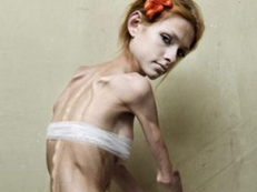 Cuoc chien size 0 trong lang mau quoc te hinh anh