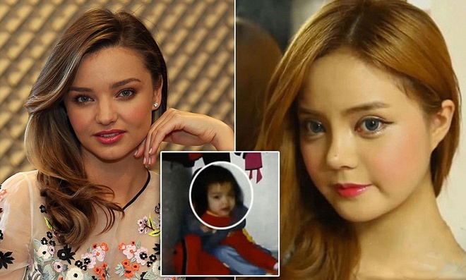 Hàn Quốc là nước có tỷ lệ phẫu thuật thẩm mĩ nhiều nhất thế giới, nhưng trường hợp dùng dao kéo để giống hệt thần tượng như Yuh Reum cũng vấp phải nhiều tranh cãi và phản đối...