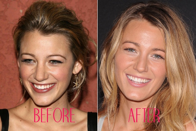Blake Lively