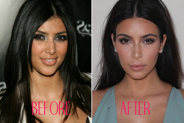 Kim Kardashian
