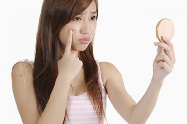 Nhung hieu lam khong ngo ve nguyen nhan gay ra mun hinh anh