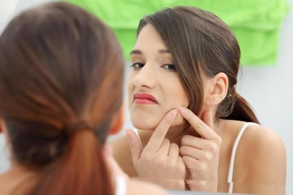 2. Mụn: Stress và mụn trứng cá có mối quan hệ rất phức tạp và đối với những người trưởng thành, mụn trứng cá rất dễ trở thành một trong những vấn đề lớn nhất do stress gây ra. Việc lo lắng về những nốt mụn và nặn mụn sẽ chỉ làm lây lan các vi khuẩn góp phần khiến da nổi mụn và khiến tình trạng càng tồi tệ hơn. Hãy giữ mức độ căng thẳng trong tầm kiểm soát để nó không kéo theo những nốt mụn trên da.