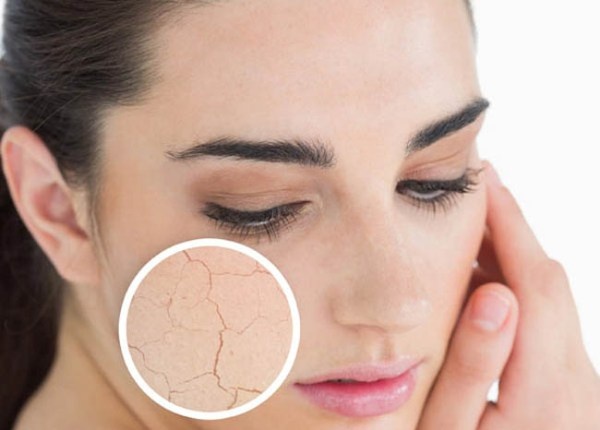 4. Làm trầm trọng những vấn đề về da: Chàm, vẩy nến và trứng cá đỏ đều chịu ảnh hưởng từ mức độ căng thẳng, nhưng ngay cả khi không gặp phải bất kỳ vấn đề nào về da, bạn vẫn có thể trở thành nạn nhân của stress. Phát ban và nổi mẩn do stress sẽ làm da bạn kém đẹp hơn hẳn.