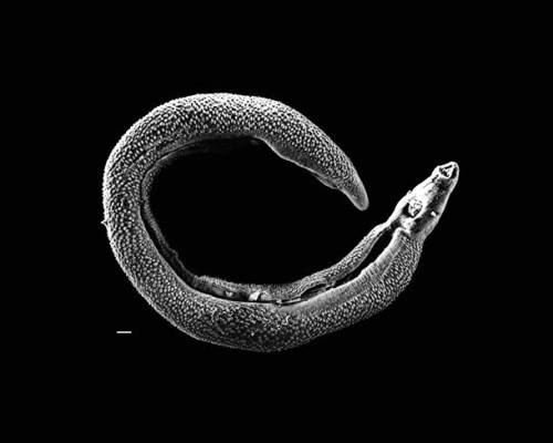 7. Giun trong thận: Tháng 11/2014, một người phụ nữ 76 tuổi ở Cộng hòa Séc bị đau ruột nặng và ra máu khi đi tiểu. Các bác sĩ đã tìm thấy hai con giun dài khoảng 10 cm trong thận của bà. Họ cho rằng những con giun này đã xâm nhập vào cơ thể người phụ nữ sau khi bà ăn cá mà không được nấu chín đúng cách.