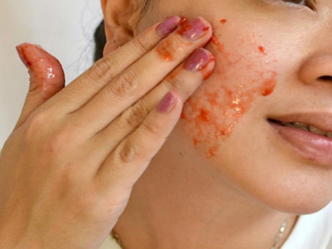 4. Làm mềm vùng da bị khô sần. Thoa lên mặt và vùng da bị khô sần hỗn hợp gồm 1 muỗng cà phê nước ép dưa hấu trộn với 1 muỗng cà phê mật ong nguyên chất, để khô trong vòng 15 – 20 phút trước khi rửa sạch với nước ấm. Mật ong là một chất giữ ẩm tự nhiên, thấm sâu vào da và làm da ngậm nước từ bên trong, kết hợp công dụng dưỡng ẩm và cung cấp nước từ quả dưa hấu, giúp làn da của bạn mềm mại hơn ngay sau lần đầu sử dụng.