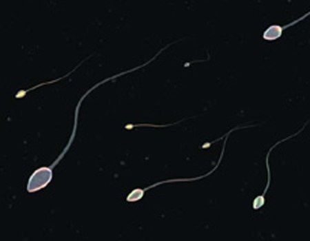  Giai ma nguyen nhan quy ong khong co tinh trung-Hinh-5 Tinh trùng sản xuất quá ít. Khi tinh hoàn suy giảm chức năng nặng và sản xuất rất ít tinh trùng. Tuy nhiên, khi sinh thiết tinh hoàn và có thể tìm thấy ít tinh trùng ở một số nơi trong tinh hoàn.