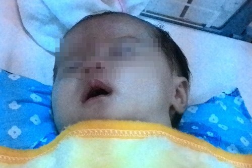 Cuu song be gai hon thang tuoi bi sac sua hinh anh