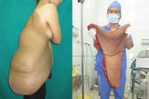 Nhung ca benh hi huu khien cac bac si phai nho mai hinh anh