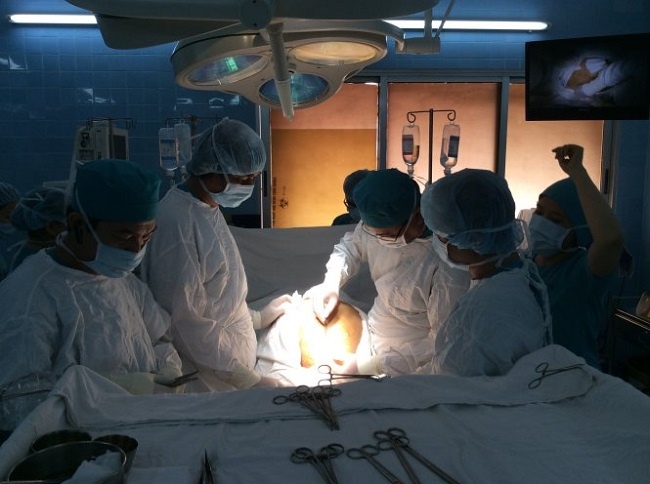 Hình cắt u 26 kg ở Bệnh viện Ung Bướu - Ảnh: BV cung cấp