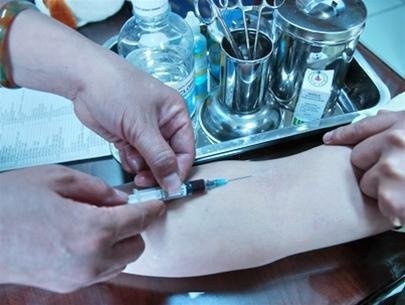 Dụng cụ kiểm tra nhiễm HIV với độ chính xác không thua kém so với xét nghiệm tại cơ sở y tế - Ảnh minh họa