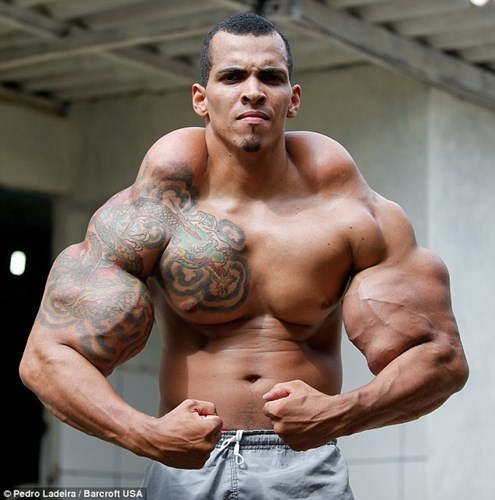 Bắp tay khủng của Romario Dos Santos Alves sau tiêm hợp chất giữa dầu và rượu.