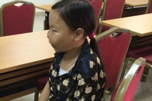 Can benh khien thieu nu mai o trong hinh hai tre em hinh anh