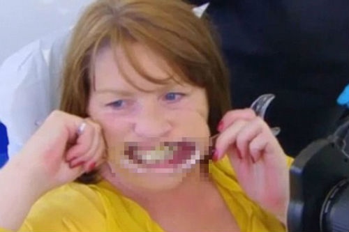 Mat ham tren vi dung keo dan rang vao loi hinh anh